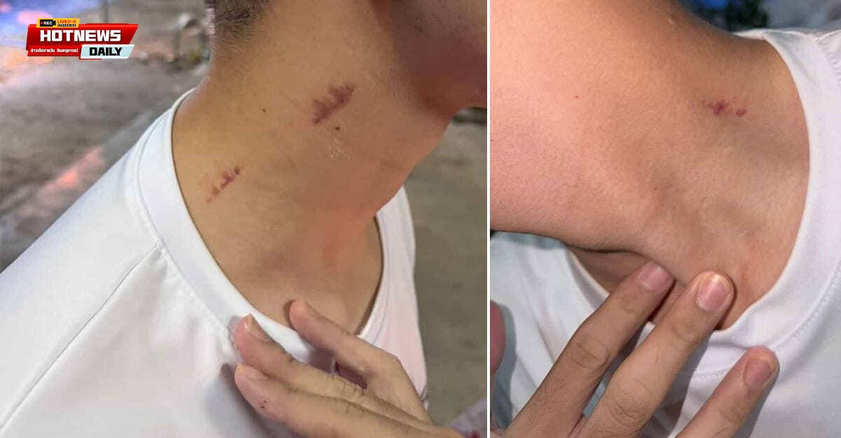 รุมดูดคอ