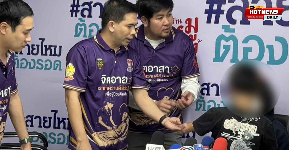 ครูสั่งเด็กเผารังแตน