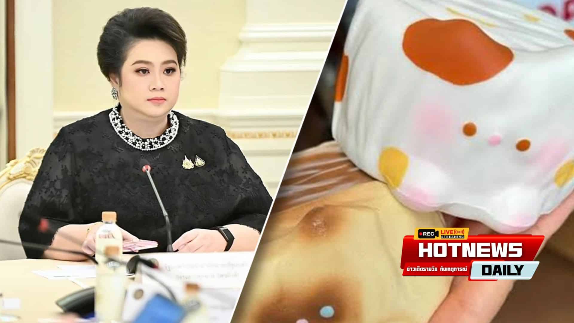 สกุชชี่อันตราย